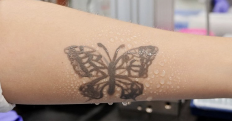 Учені розробили татуювання, яке відстежуватиме стан здоров’я людей